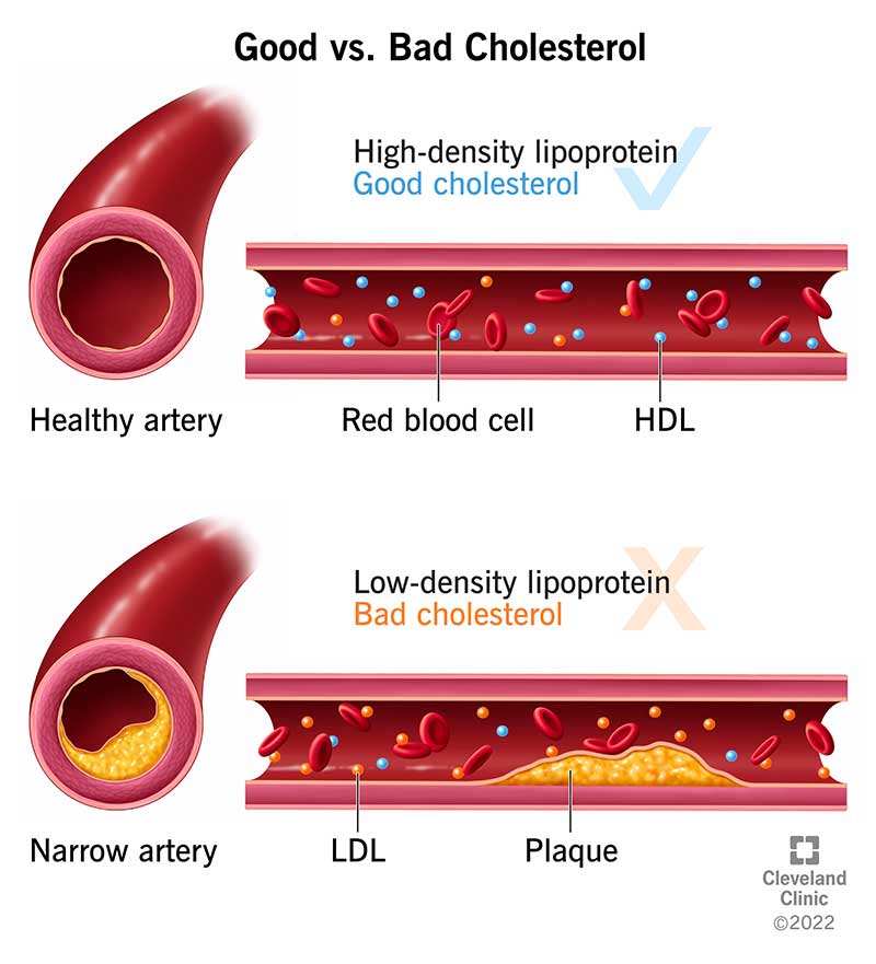 How Cholesterol Works Essential Health Insights